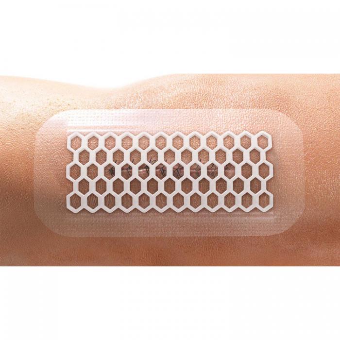 Opsite postop visible 15x10cm (1st)° medisch materiaal